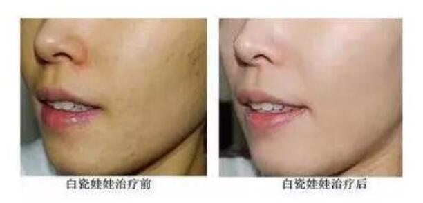 說了很多次黑臉娃娃，那白瓷娃娃的作用和功是什么呢？