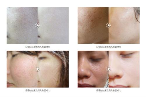 說了很多次黑臉娃娃，那白瓷娃娃的作用和功是什么呢？