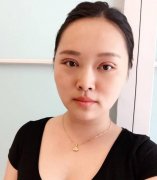 感受到了玻尿酸注射隆鼻果，小小一陣改變還挺大~