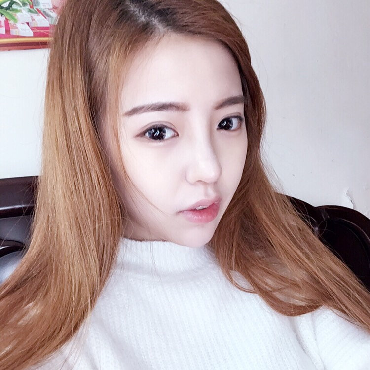 葉麗萍醫(yī)生-鼻子案例-口碑-上海華美整形