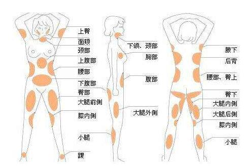 什么是腹部吸脂手術?