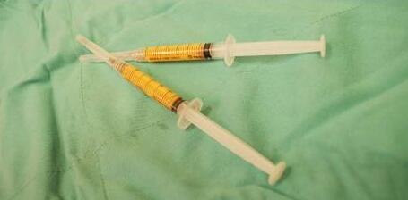 面部脂肪填充后臉特別油是什么情況?