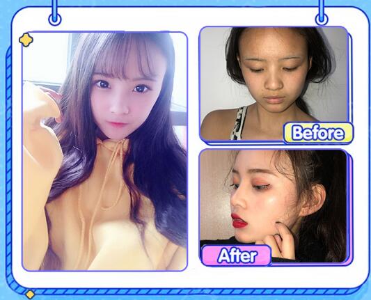 聶志宏醫(yī)生擅長項(xiàng)目