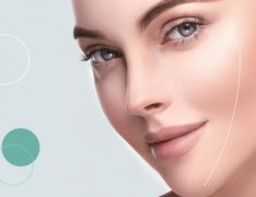 面部吸脂手術(shù)后戴幾天頭套？需要24小時都戴著嗎？