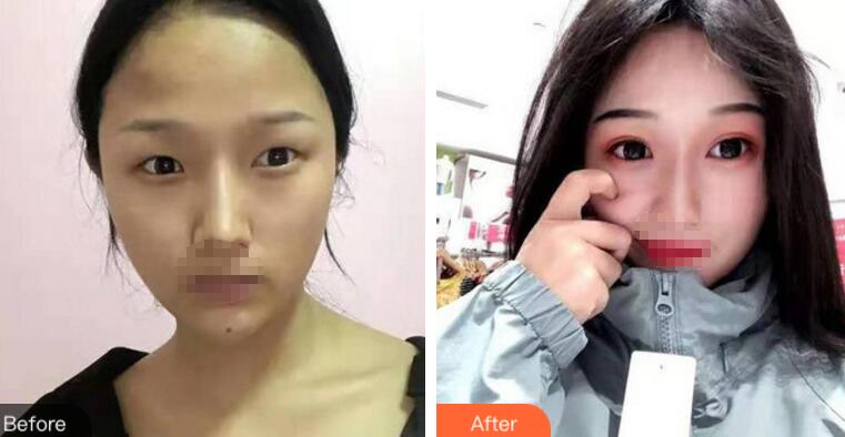 煙臺華怡整形醫(yī)雙眼皮院好么