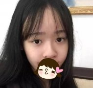 【案例】煙臺鵬愛整形醫(yī)院隆鼻經(jīng)歷，附整形價(jià)格表