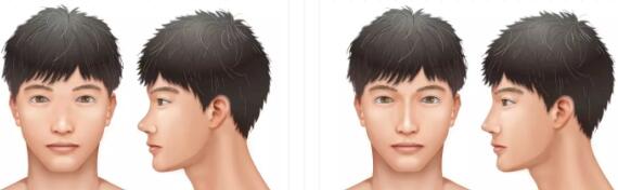 鼻子部分的線條