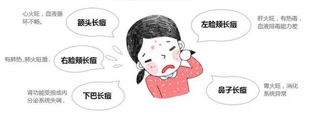 怎樣去除青春痘疤痕有又徹底？趕走痘痘肌~