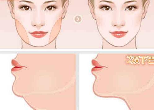 做面部吸脂皮膚會變松弛嗎？把抗衰正確的寫進(jìn)日程里
