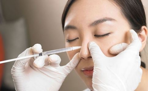 如何注射玻尿酸？注射玻尿酸隆鼻的步驟