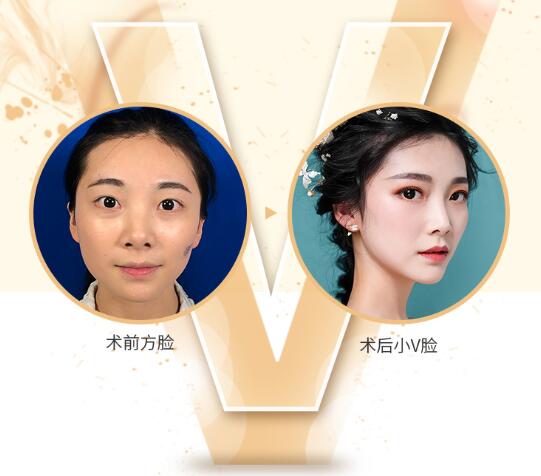 如何避免風(fēng)險(xiǎn)?