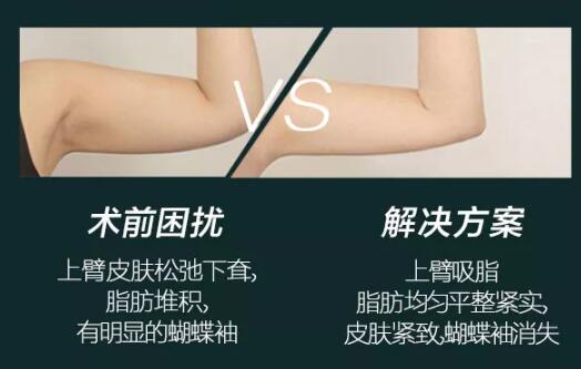 手臂吸脂手術(shù)術(shù)后注意事項