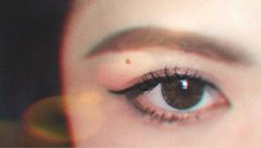 聽說雙眼皮失敗后不能馬上修復(fù)？修復(fù)的黃金時間要牢記