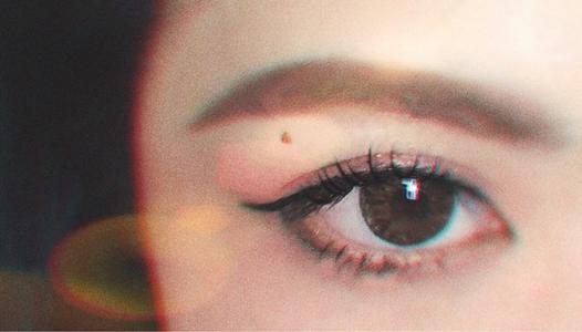 聽說雙眼皮失敗后不能馬上修復？修復的黃金時間要牢記