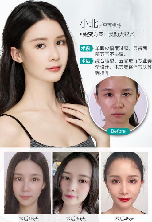 張姣姣醫(yī)生：長(zhǎng)沙雙眼皮專(zhuān)家個(gè)人資質(zhì)詳情