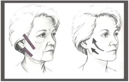 減少魚尾紋的方法