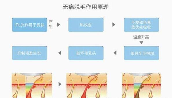 光子脫毛的危害