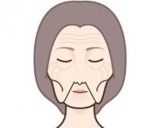 嘴角皺紋怎么消除？日常護(hù)膚or醫(yī)美方法真的管用嗎