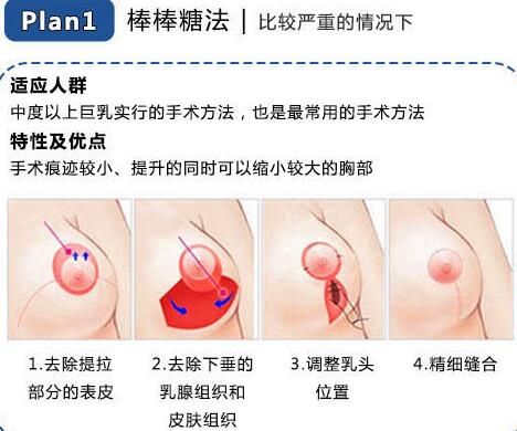 李青峰醫(yī)生_基本資料_點評_武警黑龍江總隊整形中心