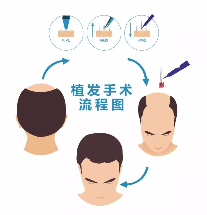 怎么樣調(diào)節(jié)脫發(fā)