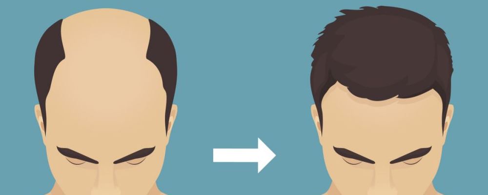 怎么樣調(diào)節(jié)脫發(fā)