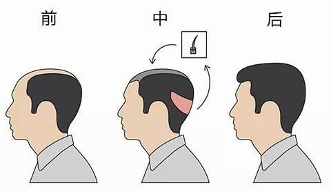 怎么樣調(diào)節(jié)脫發(fā)