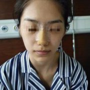 耳軟骨墊鼻梁做出了自然的果，超愛~