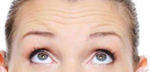 抬頭紋怎么祛除？這3種方法就很管用！