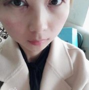 陳煥然在哪家醫(yī)院？雙眼皮案例反饋