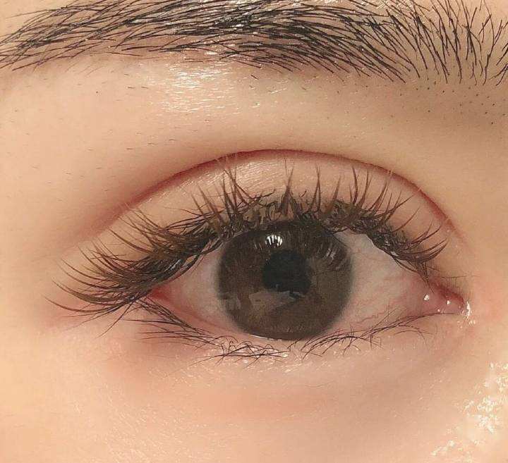 北京割雙眼皮多少錢