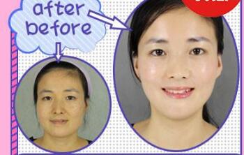 水楊酸祛痘缺點(diǎn)