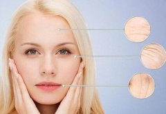 怎樣快速去除魚尾紋？去除魚尾紋的方式匯總！