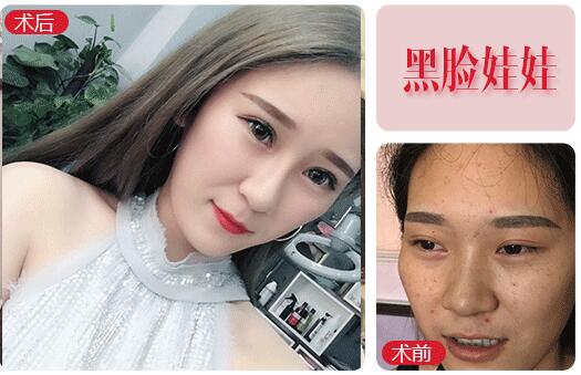 白瓷娃娃黑臉娃娃