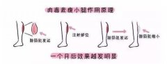 注射瘦腿有用嗎？簡(jiǎn)單分析原理，讓你瘦得放心！