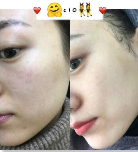 醫(yī)生點(diǎn)評(píng)