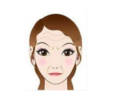 怎么樣去除抬頭紋