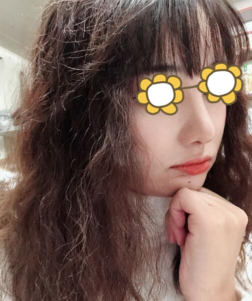 黃志祥醫(yī)生的術(shù)后評(píng)價(jià)