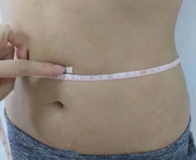 劉培醫(yī)生的手術(shù)案例