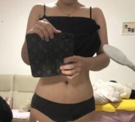 劉培醫(yī)生的術(shù)后評價(jià)