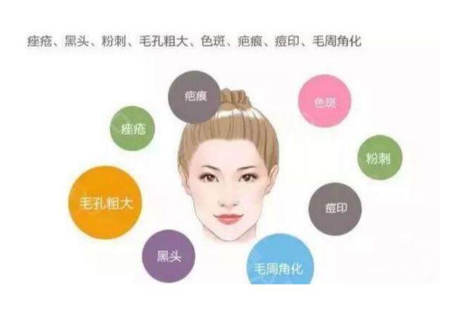 果酸換膚會反彈嗎