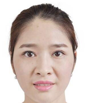 張嬌嬌醫(yī)生的術(shù)后評(píng)價(jià)