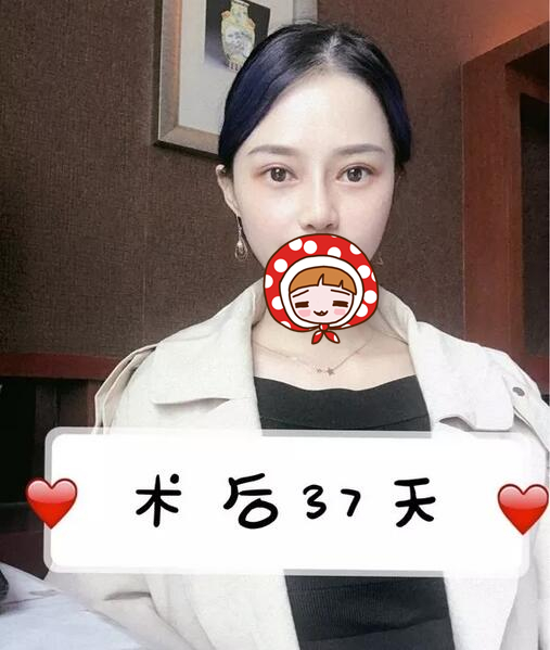 醫(yī)生的術(shù)后評(píng)價(jià)