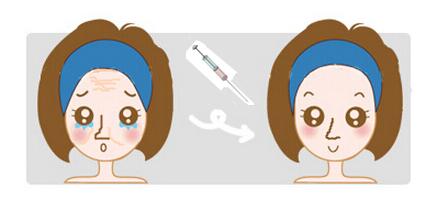 自體脂肪填充與玻尿酸填充詳細(xì)區(qū)別