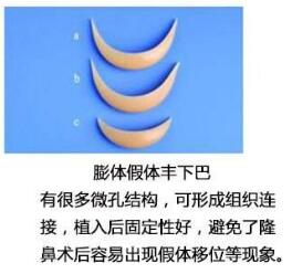 整形墊下巴做的好