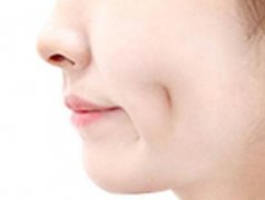 福州弘宇整形醫(yī)院人造酒窩有哪些特點(diǎn) 讓你成為萬人迷