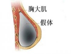 煙臺美神整形醫(yī)院乳房再造果怎么樣 讓你找回女人自信