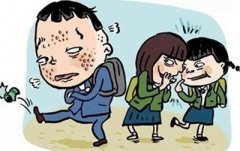 石家莊美聯(lián)臣激光祛痤瘡果好嗎 大概需要多少錢