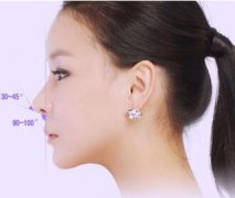 福州亞美整形醫(yī)院鼻尖整形會(huì)出現(xiàn)后遺癥嗎 有什么特點(diǎn)呢