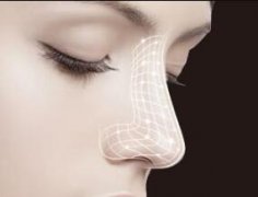 蘭州鼻整形醫(yī)院匯總 鼻翼縮小有哪些優(yōu)勢呢