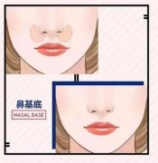 對鼻基底進行填充的作用 是為了讓你與別人的與眾不同